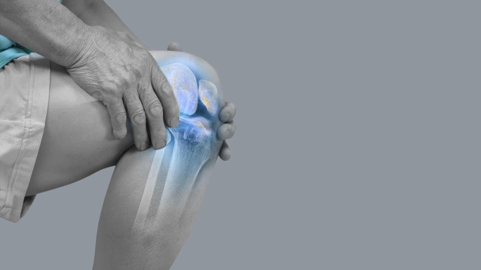 Rheumatoid Arthritis After Hysterectomy Rheumatoid Arthritis After Hysterectomy