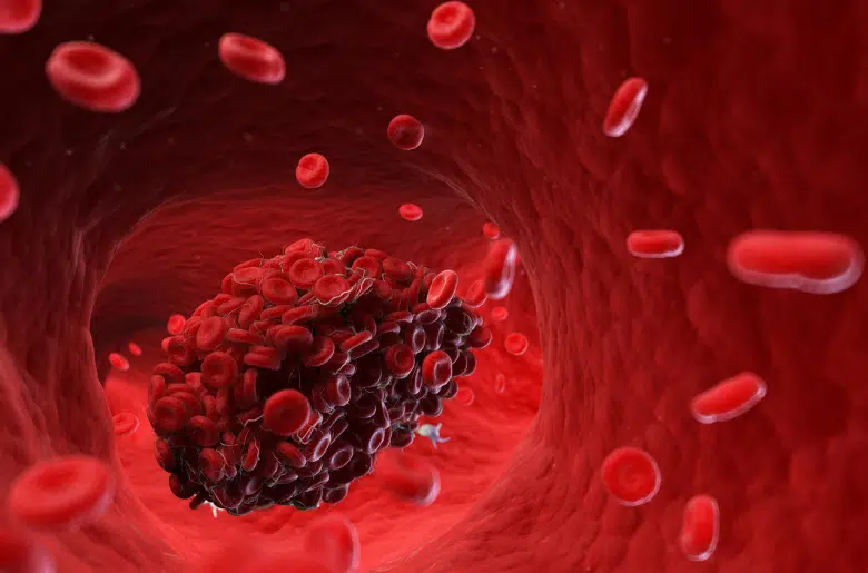 website blog image front (5) Blood Disorders