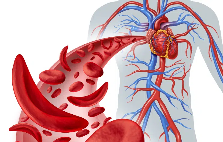 website blog images (6) Blood Disorders